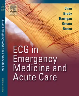 Chan / Brady / Harrigan |  ECG in Emergency Medicine and Acute Care | Buch |  Sack Fachmedien