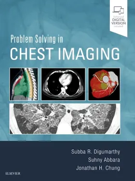 Digumarthy / Abbara / Chung |  Problem Solving in Chest Imaging | Buch |  Sack Fachmedien