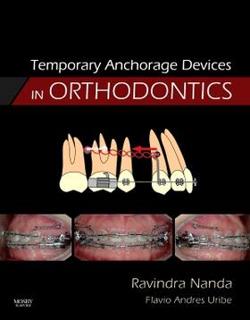 Nanda |  Temporary Anchorage Devices in Orthodontics | Buch |  Sack Fachmedien
