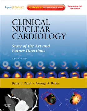 Zaret / Beller |  Clinical Nuclear Cardiology: State of the Art and Future Directions | Buch |  Sack Fachmedien