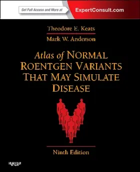 Keats / Anderson |  Atlas of Normal Roentgen Variants That May Simulate Disease | Buch |  Sack Fachmedien