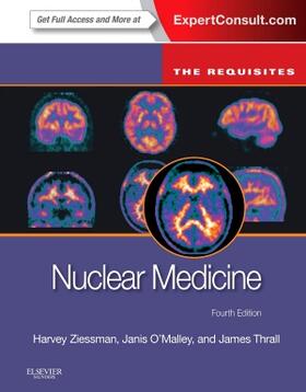 Ziessman / O'Malley | Nuclear Medicine: The Requisites | Buch | 978-0-323-08299-0 | sack.de