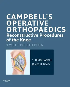 Canale / Beaty |  Campbell's Operative Orthopaedics: Reconstructive Procedures of the Knee E-Book | eBook | Sack Fachmedien