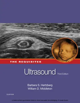 Hertzberg MD / Middleton MD |  Ultrasound: The Requisites | eBook | Sack Fachmedien