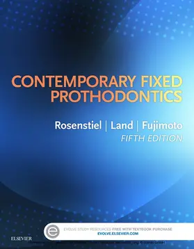 Rosenstiel / Land |  Contemporary Fixed Prosthodontics - E-Book | eBook | Sack Fachmedien