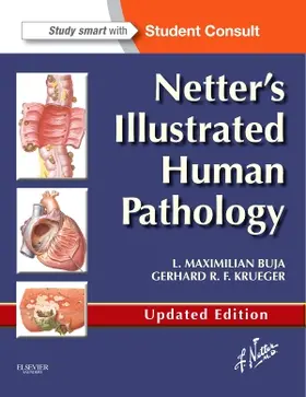 Krueger |  Netter's Illustrated Human Pathology Updated Edition | Buch |  Sack Fachmedien