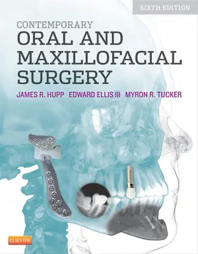 Hupp DMD / Tucker DDS / Ellis |  Contemporary Oral and Maxillofacial Surgery - E-Book | eBook | Sack Fachmedien
