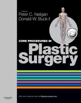 Neligan / Buck II | Core Procedures in Plastic Surgery | Buch | 978-0-323-24399-5 | sack.de