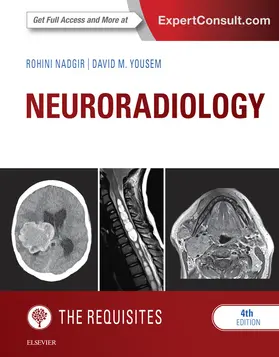 Nadgir MD / Nadgir / Yousem MD |  Neuroradiology: The Requisites E-Book | eBook | Sack Fachmedien