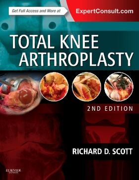 Scott | Total Knee Arthroplasty | Buch | 978-0-323-28663-3 | sack.de