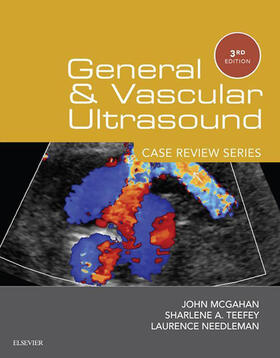 Needleman | General and Vascular Ultrasound: Case Review Series | E-Book | sack.de