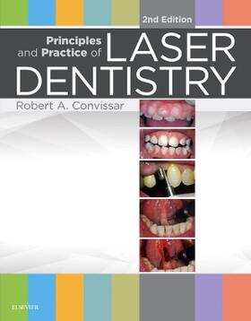 Convissar |  Principles and Practice of Laser Dentistry | Buch |  Sack Fachmedien