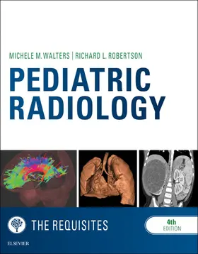 Walters MD / Walters / Robertson MD |  Pediatric Radiology: The Requisites E-Book | eBook | Sack Fachmedien