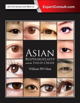 Chen | Asian Blepharoplasty and the Eyelid Crease | Buch | 978-0-323-35572-8 | www.sack.de