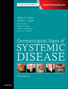 Callen / Jorizzo / Zone | Dermatological Signs of Systemic Disease | Buch | 978-0-323-35829-3 | sack.de