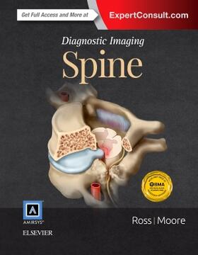 Ross / Moore | Diagnostic Imaging: Spine | Buch | 978-0-323-37705-8 | sack.de