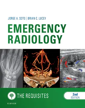 Soto MD / Lucey MD |  Emergency Radiology: The Requisites E-Book | eBook | Sack Fachmedien