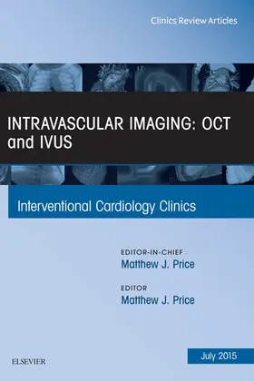 Price |  Intravascular Imaging: OCT and IVUS, An Issue of Interventional Cardiology Clinics | eBook | Sack Fachmedien