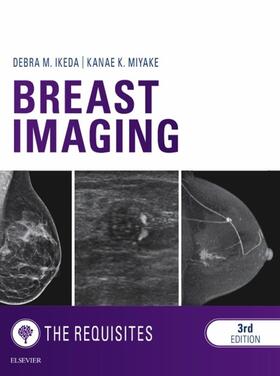 Ikeda | Breast Imaging: The Requisites | E-Book | sack.de