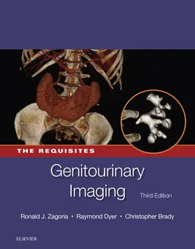 Zagoria MD / Brady MD / Dyer MD |  Genitourinary Imaging: The Requisites E-Book | eBook | Sack Fachmedien