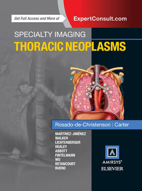 Specialty Imaging: Thoracic Neoplasms | E-Book | sack.de