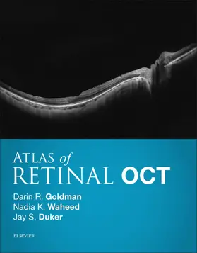 Goldman MD / Goldman / Waheed MD MPH |  Atlas of Retinal OCT E-Book | eBook | Sack Fachmedien