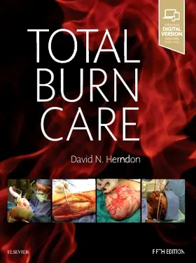 Herndon |  Total Burn Care | Buch |  Sack Fachmedien