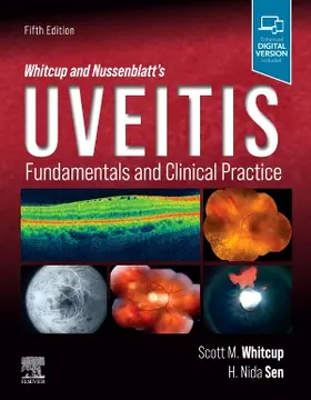 Whitcup / Sen |  Whitcup and Nussenblatt's Uveitis | Buch |  Sack Fachmedien