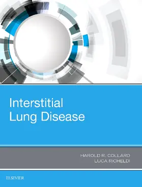Collard MD / Richeldi |  Interstitial Lung Disease E-Book | eBook | Sack Fachmedien
