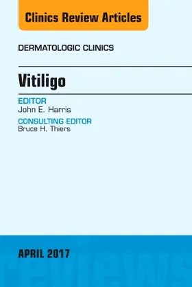 Harris | Vitiligo, an Issue of Dermatologic Clinics | Buch | 978-0-323-52404-9 | www.sack.de