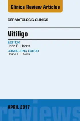 Harris |  Vitiligo, An Issue of Dermatologic Clinics | eBook | Sack Fachmedien