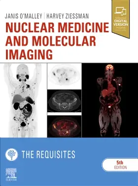 O'Malley / Ziessman | Nuclear Medicine and Molecular Imaging: The Requisites | Buch | 978-0-323-53037-8 | sack.de