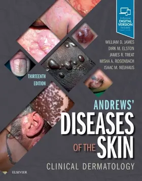 James / Elston / Treat |  Andrews' Diseases of the Skin | Buch |  Sack Fachmedien