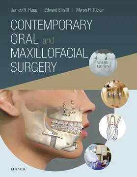 Hupp / Tucker / Ellis |  Contemporary Oral and Maxillofacial Surgery E-Book | eBook | Sack Fachmedien