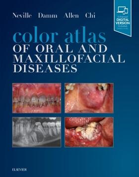 Neville / Damm / Allen | Color Atlas of Oral and Maxillofacial Diseases | Buch | sack.de