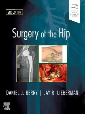Berry / Lieberman |  Surgery of the Hip | Buch |  Sack Fachmedien
