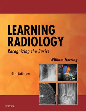 Herring |  Learning Radiology | eBook | Sack Fachmedien