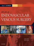 Almeida |  Atlas of Endovascular Venous Surgery E-Book | eBook | Sack Fachmedien