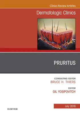 Yosipovitch |  Pruritus, An Issue of Dermatologic Clinics | eBook | Sack Fachmedien