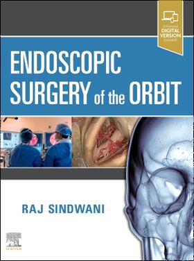 Sindwani | Endoscopic Surgery of the Orbit | Buch | 978-0-323-61329-3 | sack.de