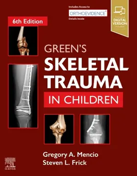 Mencio |  Green's Skeletal Trauma in Children | Buch |  Sack Fachmedien