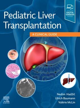 Hadzic / Baumann / MCLIN | Pediatric Liver Transplantation | Buch | 978-0-323-63671-1 | sack.de