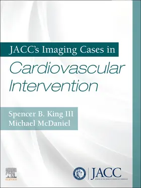 King / Mcdaniel |  JACC's Imaging Cases in Cardiovascular Intervention E-Book | eBook | Sack Fachmedien