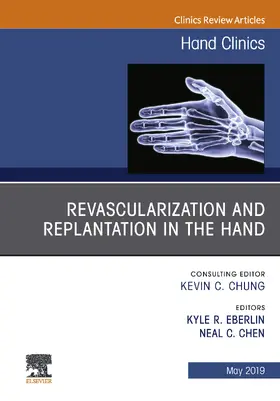 Eberlin / Chen |  Revascularization and Replantation in the Hand, An Issue of Hand Clinics | eBook | Sack Fachmedien