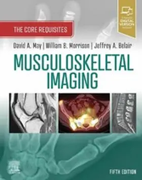 May MD / Morrison MD / Belair |  Musculoskeletal Imaging: The Core Requisites E-Book | eBook | Sack Fachmedien