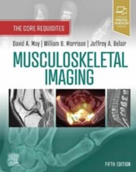 Musculoskeletal Imaging: The Core Requisites E-Book | E-Book | sack.de