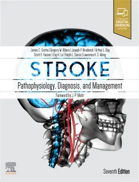 Day / Grotta / Lo | Stroke | Buch | 978-0-323-69424-7 | www.sack.de