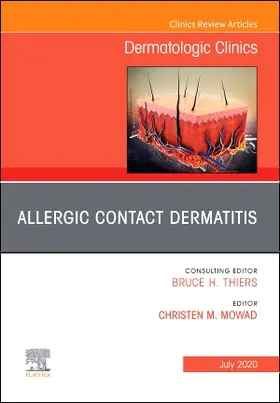Mowad | Allergic Contact Dermatitis, an Issue of Dermatologic Clinics | Buch | 978-0-323-71213-2 | www.sack.de