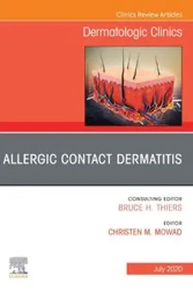 Mowad | Allergic Contact Dermatitis,An Issue of Dermatologic Clinics - E-Book | E-Book | www.sack.de