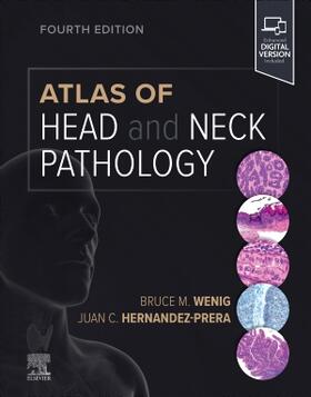Wenig / Hernandez-Prera | Atlas of Head and Neck Pathology | Buch | 978-0-323-71257-6 | sack.de